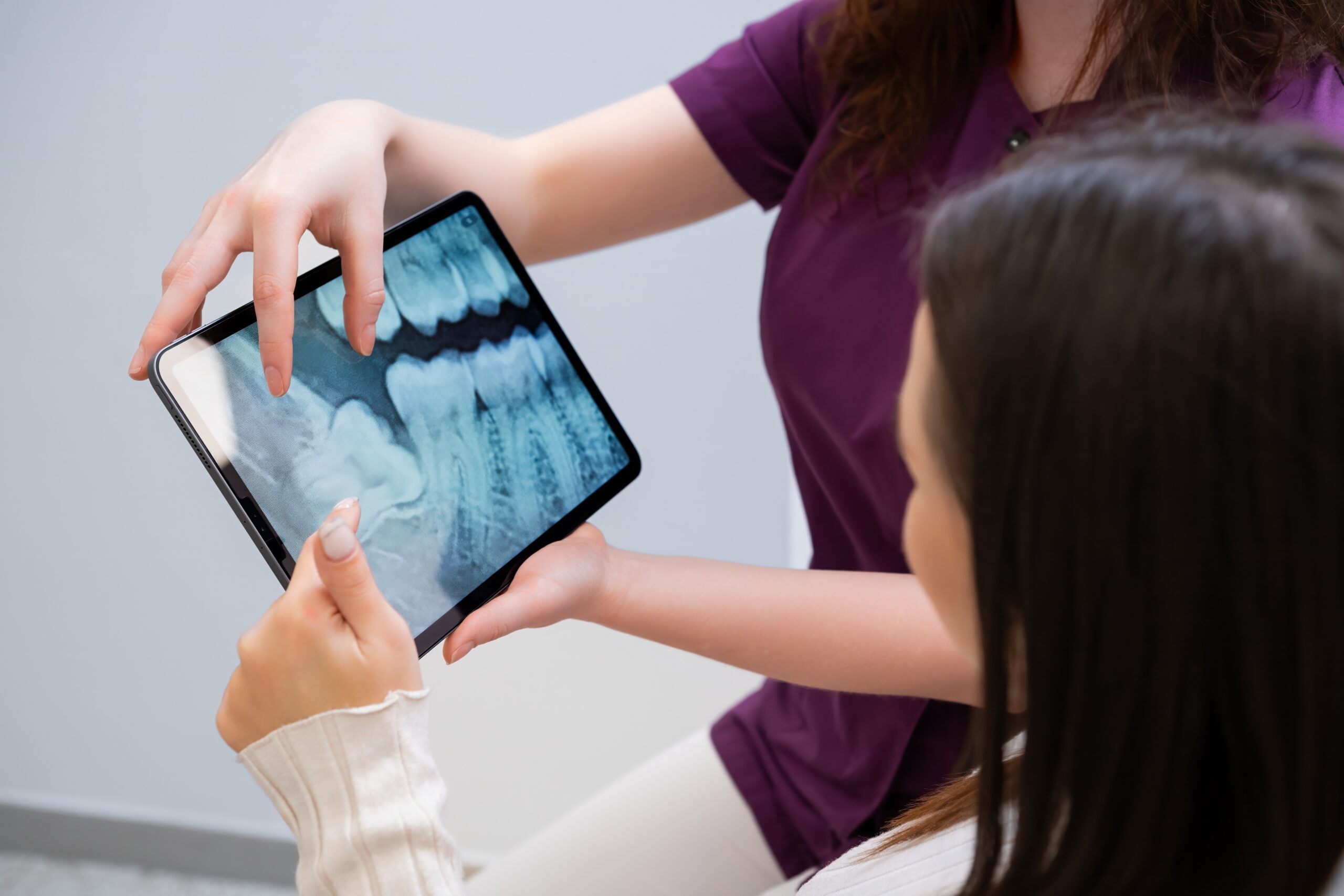 Tooth extraction procedure