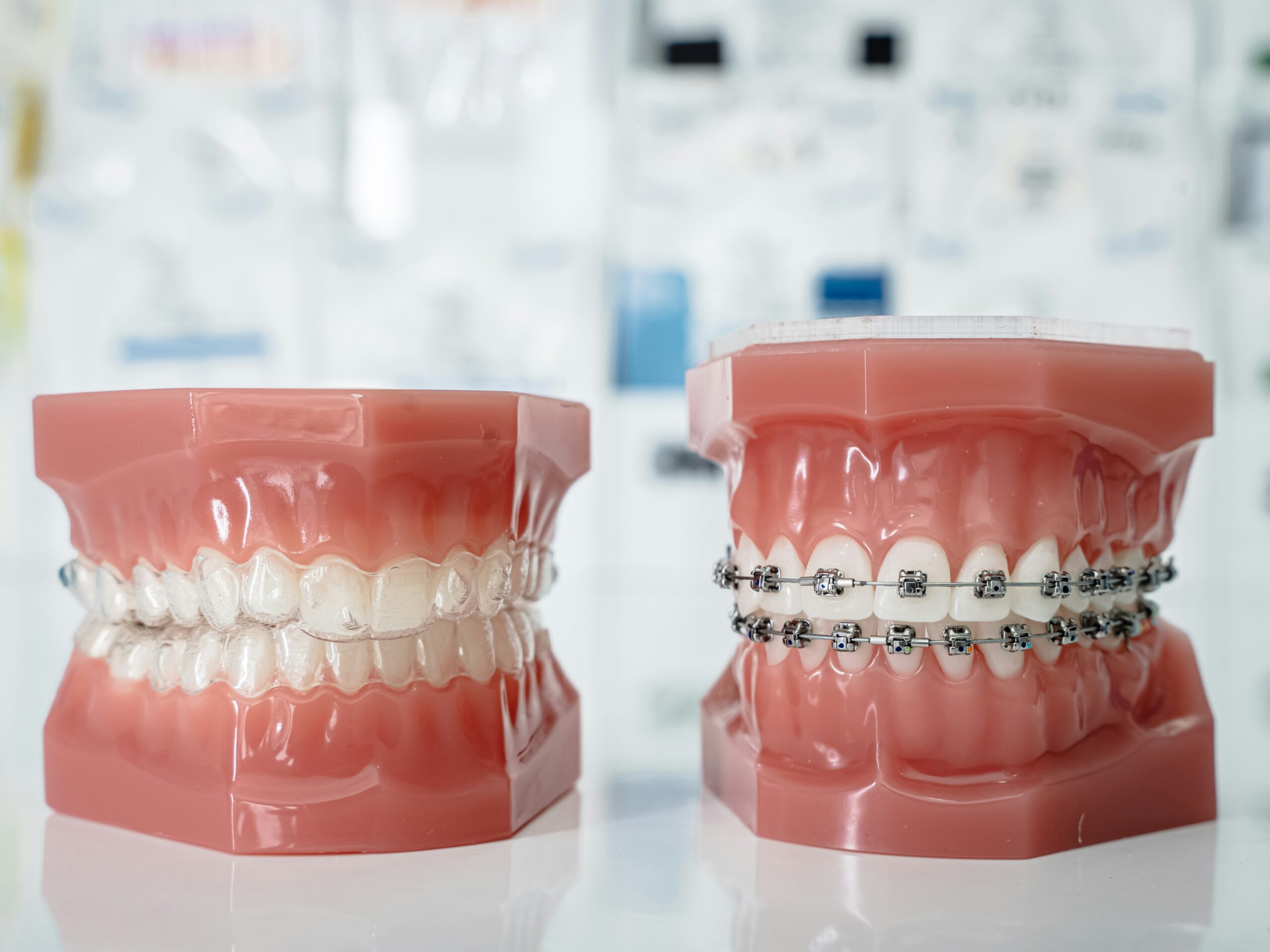 Orthodontic options